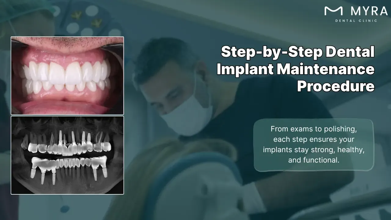 what is the procedure for dental implant maintenance